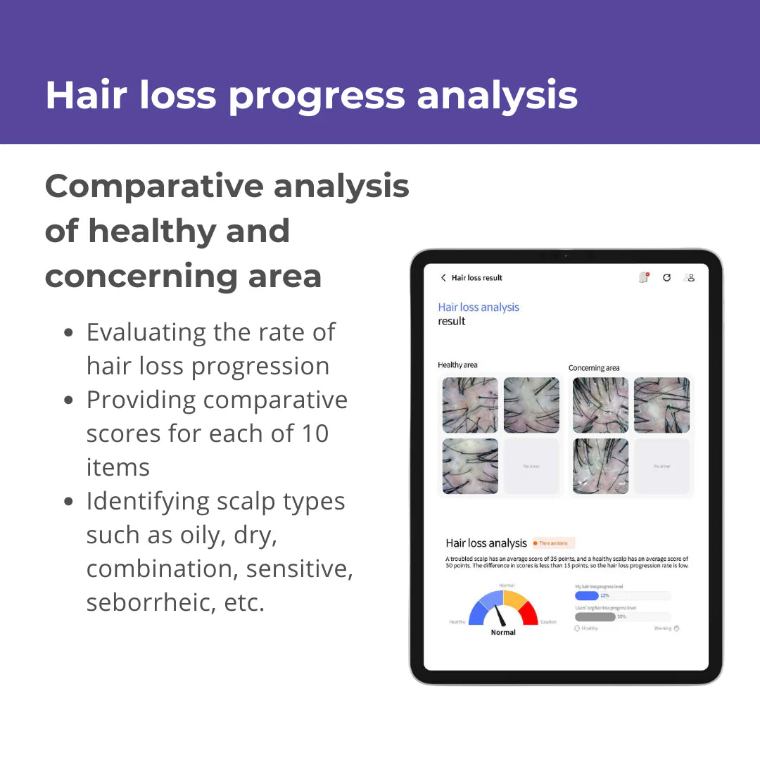 Becon AI analysis for Skin and Scalp Scanner + 1 Year Software