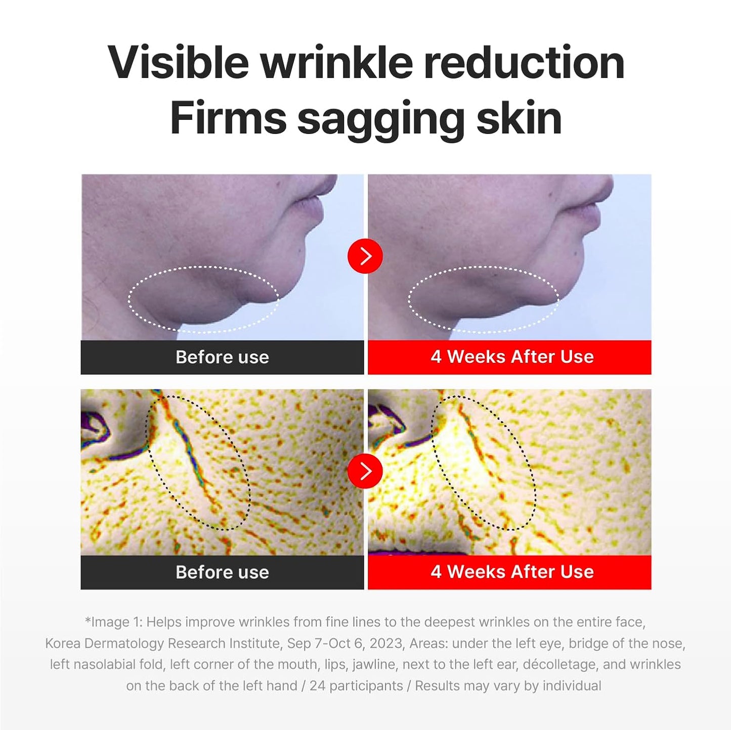 CENTELLIAN 24 MADECA CREAM TIME REVERSE (SEASON7, 50ml/1.69fl oz) | Intensive Skin Repair & Firming